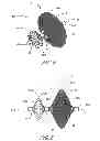 Fig. 04 - IMPLANT RETRIEVAL SYSTEM