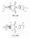 Fig. 10 - IMPLANT RETRIEVAL SYSTEM