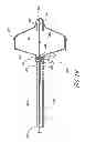 Fig. 11 - IMPLANT RETRIEVAL SYSTEM