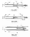 Fig. 14 - IMPLANT RETRIEVAL SYSTEM