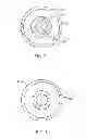Fig. 06 - Surgical Instrument with Flexible Shaft