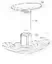 Fig. 02 - Implantable biodegradable wound closure device and method