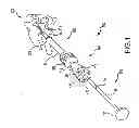 Fig. 02 - Vertebral joint implants and delivery tools