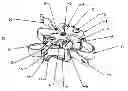 Fig. 01 - Interspinous implant