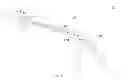 Fig. 02 - Apparatus and methods for separating internal bone fixation device from introducer