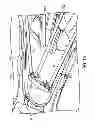 Fig. 14 - Teethbrush