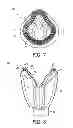 Fig. 06 - Respiratory mask with ribbed contacting surface