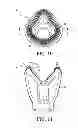 Fig. 08 - Respiratory mask with ribbed contacting surface