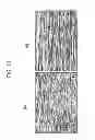 Fig. 09 - High frequency cable, high frequency coil and method for manufacturing high frequency cable