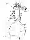 Fig. 03 - DISPENSING UNIT FOR LIQUID CONTAINERS