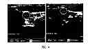 Fig. 05 - Method and system of generating a 3D visualization from 2D images