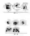 Fig. 02 - SUBSETS OF ANTIGEN-PRESENTING CELLS (APCs) IN THE HUMAN VAGINA AND THEIR DISTINCT FUNCTIONS