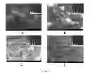 Fig. 06 - Synthetic bone grafts