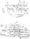 Fig. 05 - Dental implant
