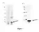 Fig. 02 - Breast Tumor Markers and Methods of Use Thereof
