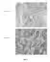 Fig. 03 - Breast Tumor Markers and Methods of Use Thereof