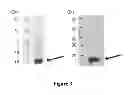 Fig. 04 - Breast Tumor Markers and Methods of Use Thereof