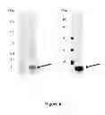 Fig. 07 - Breast Tumor Markers and Methods of Use Thereof