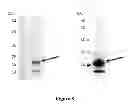 Fig. 09 - Breast Tumor Markers and Methods of Use Thereof