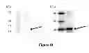 Fig. 11 - Breast Tumor Markers and Methods of Use Thereof