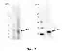 Fig. 13 - Breast Tumor Markers and Methods of Use Thereof