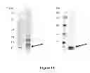 Fig. 15 - Breast Tumor Markers and Methods of Use Thereof