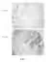 Fig. 16 - Breast Tumor Markers and Methods of Use Thereof