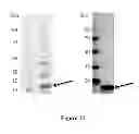 Fig. 22 - Breast Tumor Markers and Methods of Use Thereof