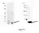 Fig. 24 - Breast Tumor Markers and Methods of Use Thereof