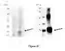 Fig. 26 - Breast Tumor Markers and Methods of Use Thereof