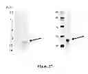 Fig. 28 - Breast Tumor Markers and Methods of Use Thereof