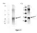 Fig. 32 - Breast Tumor Markers and Methods of Use Thereof