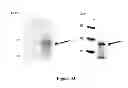 Fig. 34 - Breast Tumor Markers and Methods of Use Thereof