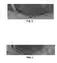 Fig. 05 - Bioprinting station, assembly comprising such bioprinting station and bioprinting method