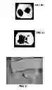 Fig. 07 - Bioprinting station, assembly comprising such bioprinting station and bioprinting method