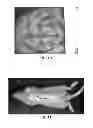 Fig. 08 - Bioprinting station, assembly comprising such bioprinting station and bioprinting method