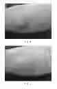 Fig. 04 - Method for assessing the condition of skin and/or scalp