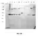 Fig. 25 - Factor VIII Compositions and Methods of Making and Using Same