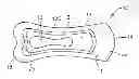 Fig. 01 - Body Adhering Absorbent Aticle