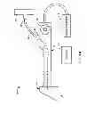 Fig. 02 - Focal Ablation Assembly