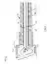 Fig. 04 - Focal Ablation Assembly