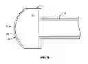 Fig. 08 - Focal ablation assembly