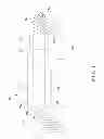 Fig. 15 - Minimally invasive crimp and cable for bone cerclage