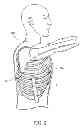 Fig. 03 - ELECTRICAL STIMULATION OF THE SYMPATHETIC NERVE CHAIN