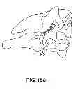 Fig. 131 - Vertebral joint implants and delivery tools