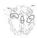 Fig. 01 - METHOD AND DEVICE FOR DETERMINING TARGET BRAIN SEGMENTS IN HUMAN OR ANIMAL BRAINS