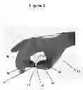 Fig. 04 - GARDENING GLOVE HAVING A CUTTING TOOL