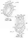 Fig. 02 - Jewelry article with changeable setting