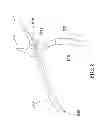 Fig. 09 - RING PLIERS