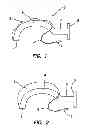 Fig. 02 - Inflatable Oral Airway Apparatus and Method for Using the Same